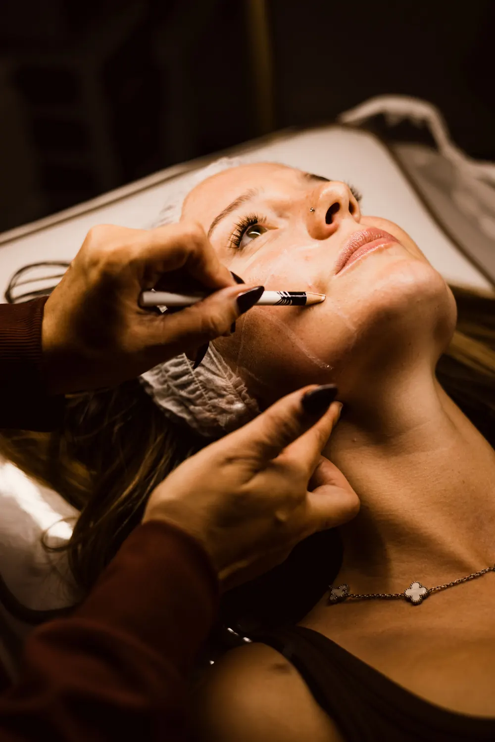 Practitioner mapping a client’s jawline before treatment