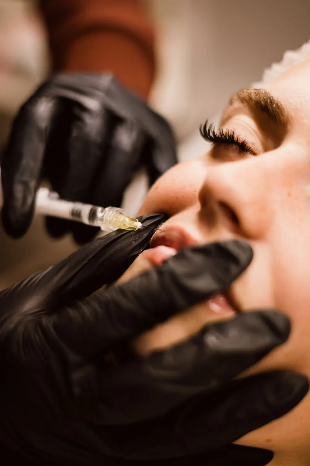 Practitioner performing a lip treatment with gloved hands
