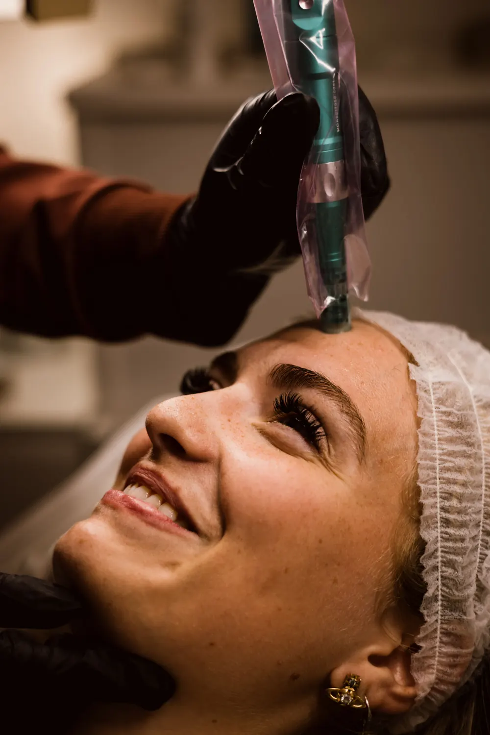 Smiling client receiving a microneedling treatment in a clinic