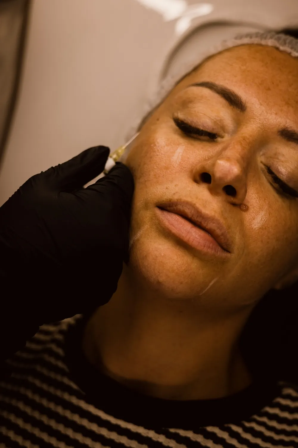 Close-up of glowing skin during an advanced skin treatment